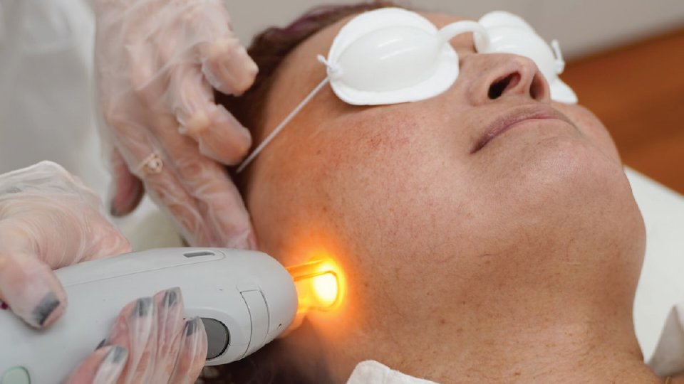 SKIN-TIGHTENNING-AT-AVISSA-SKIN-2